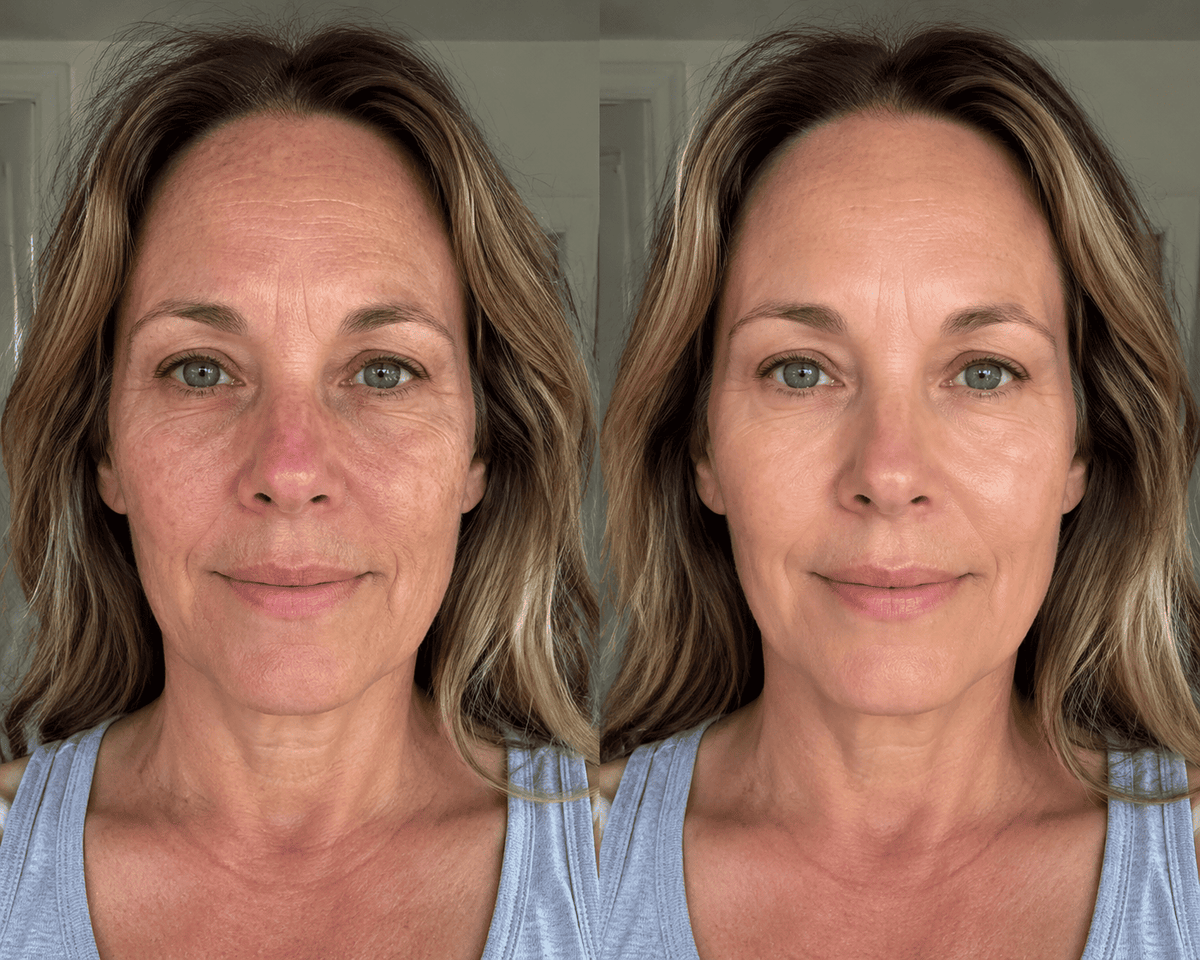 Before and after