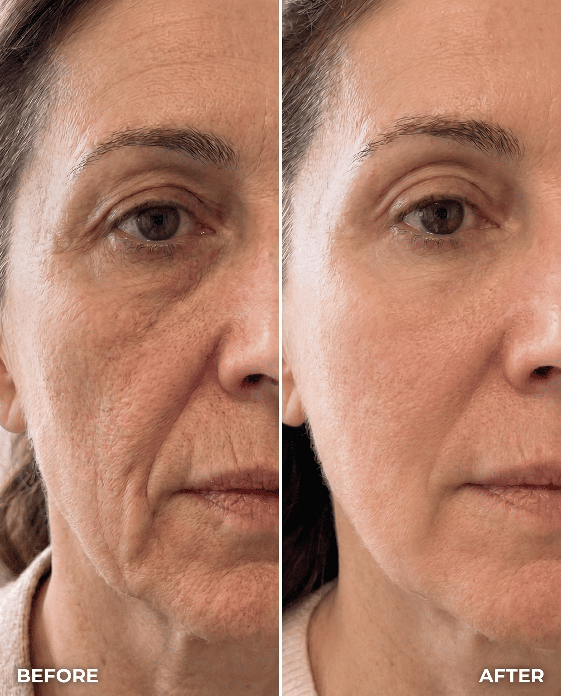Collagen Capsule Cream