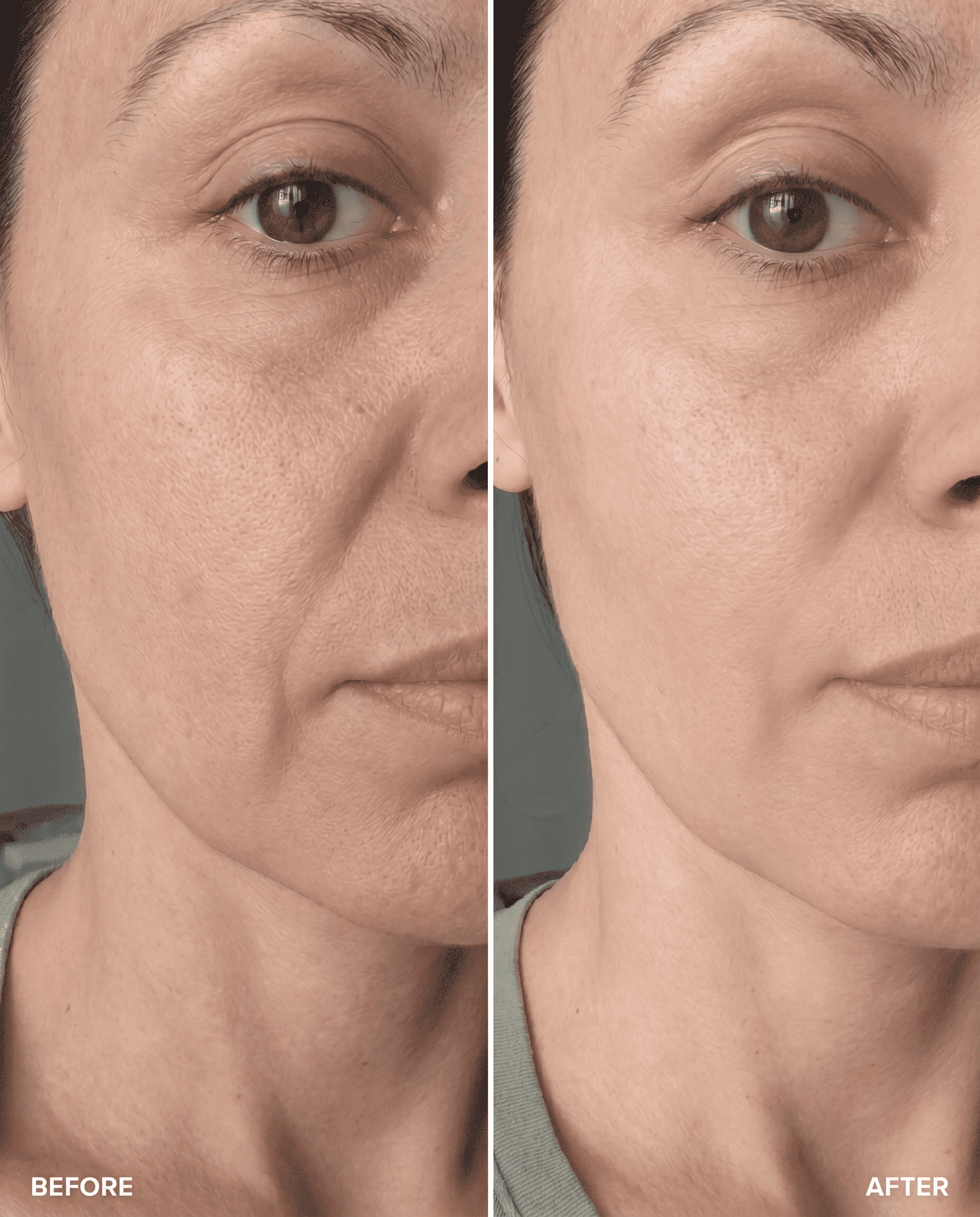Collagen Capsule Cream