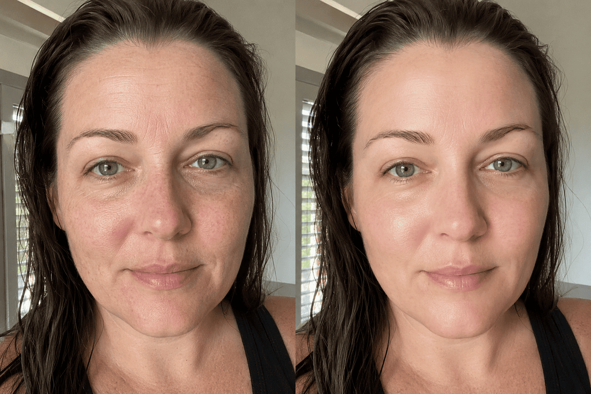 Before and after