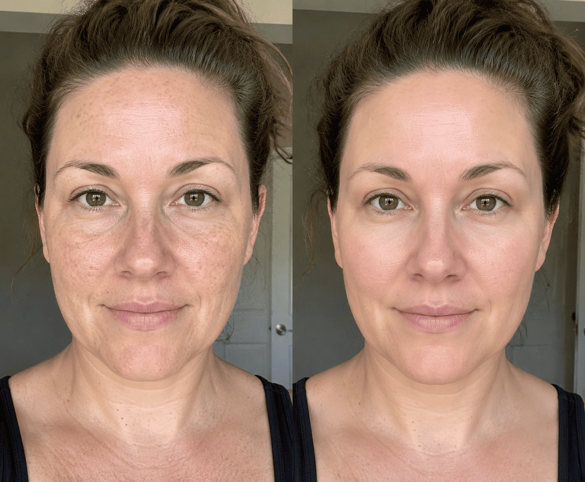 Before and after